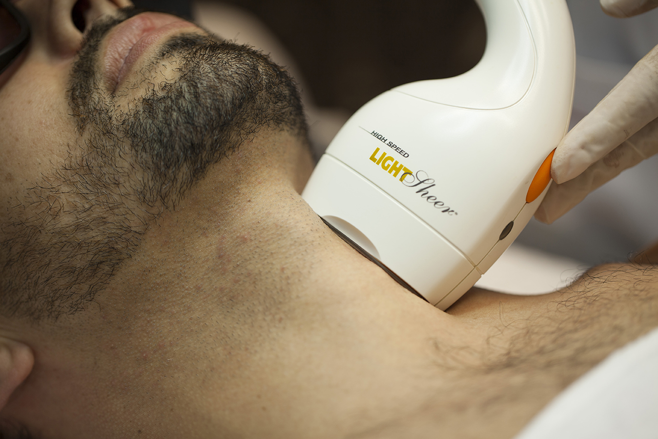 depilación laser diodo girona